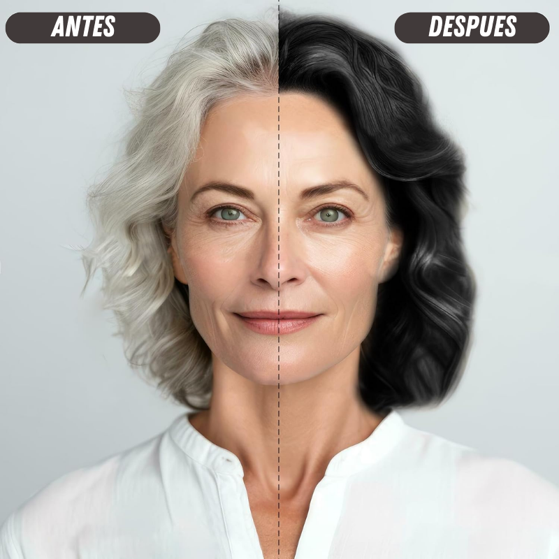 Capilux™ – Shampo Anticanas 100% Natural 🌿