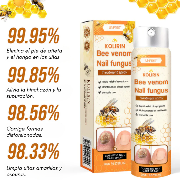 NailFungus™ - Spray para Eliminar Hongos Difíciles