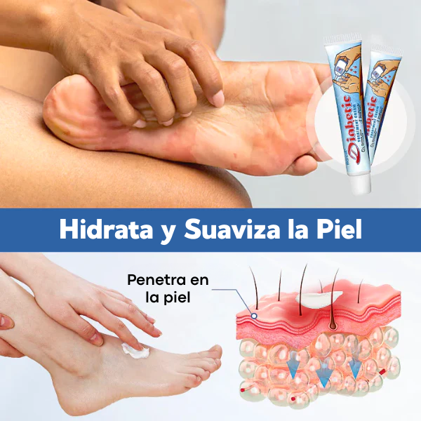 Biancat® VitaGluco Crema para el Tratamiento de la Diabetes