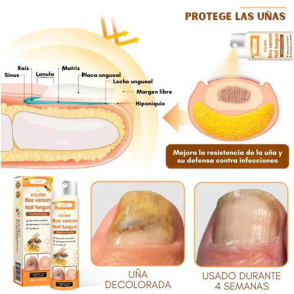 NailFungus™ - Spray para Eliminar Hongos Difíciles