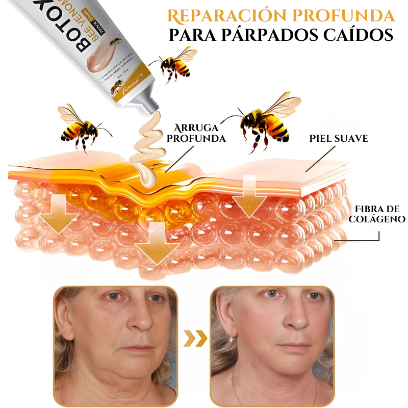 BOTOX BeeVenom™ Revolución para tu Piel
