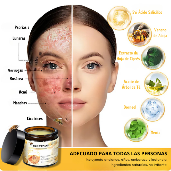 BeeLixir™ -¡Piel Perfecta SIN CIRUGÍAS ni Cicatrices!