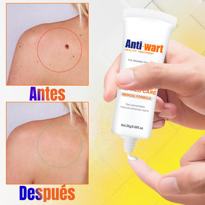 AntiWart™ - Crema Anti Verrugas Aprobada Dermatológicamente