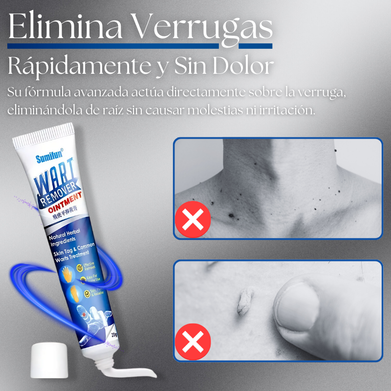 DermaErase™ ¡Piel Limpia SIN CIRUGÍAS ni Cicatrices!
