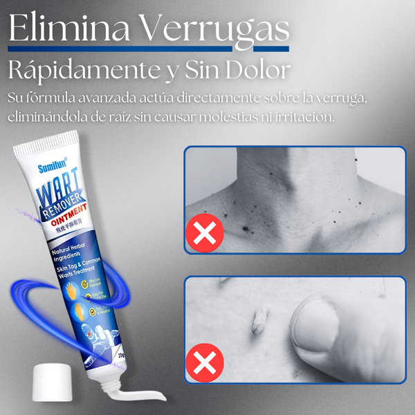 DermaErase™ ¡Piel Limpia SIN CIRUGÍAS ni Cicatrices!