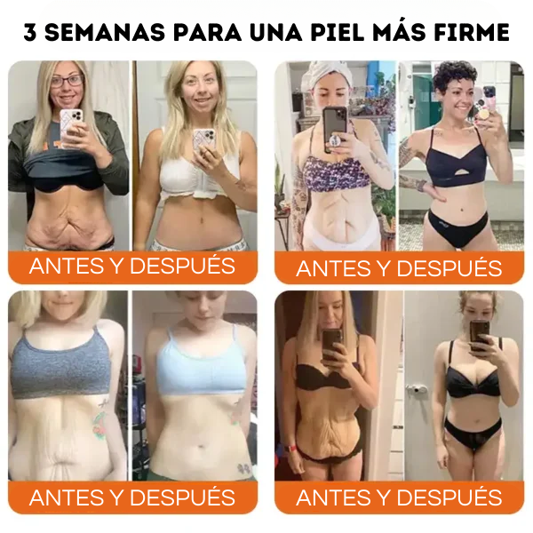 Flysmus - El Secreto para una Piel Joven y Radiante