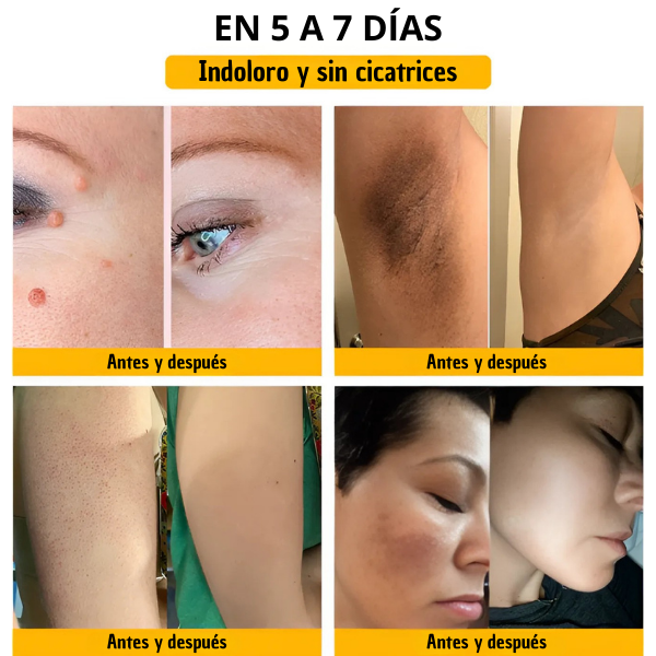 BeeLixir™ -¡Piel Perfecta SIN CIRUGÍAS ni Cicatrices!