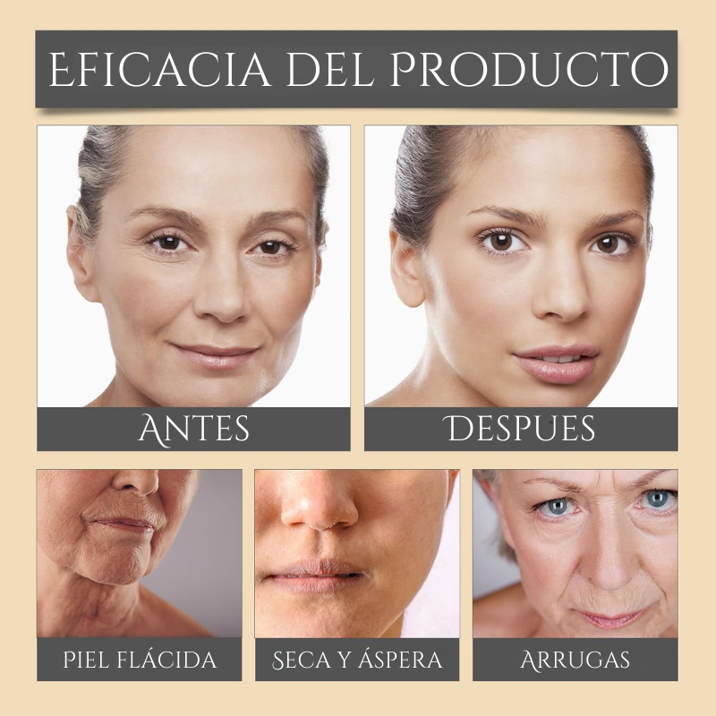 BOTOX BeeVenom™ Revolución para tu Piel