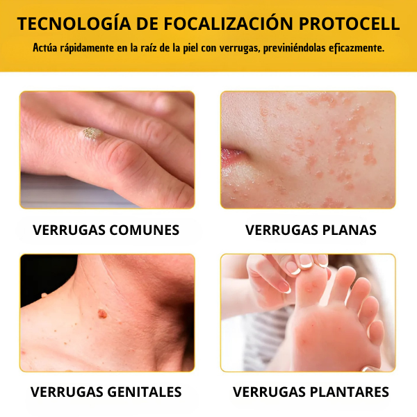 BeeLixir™ -¡Piel Perfecta SIN CIRUGÍAS ni Cicatrices!
