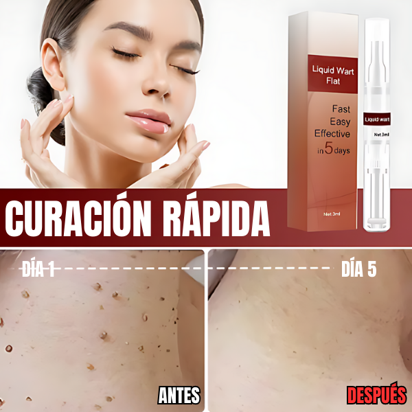 SkinClean™ - Eliminador Efectivo de Verrugas y Lunares