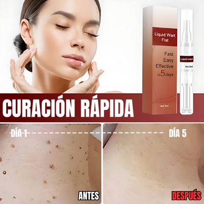 SkinClean™ - Eliminador Efectivo de Verrugas y Lunares