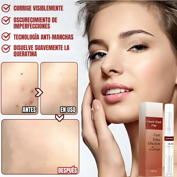SkinClean™ - Eliminador Efectivo de Verrugas y Lunares