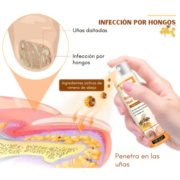 NailFungus™ - Spray para Eliminar Hongos Difíciles