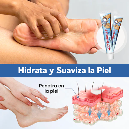 Biancat® VitaGluco Crema para el Tratamiento de la Diabetes