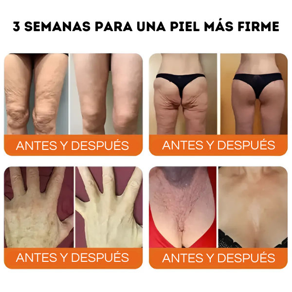 Flysmus - El Secreto para una Piel Joven y Radiante