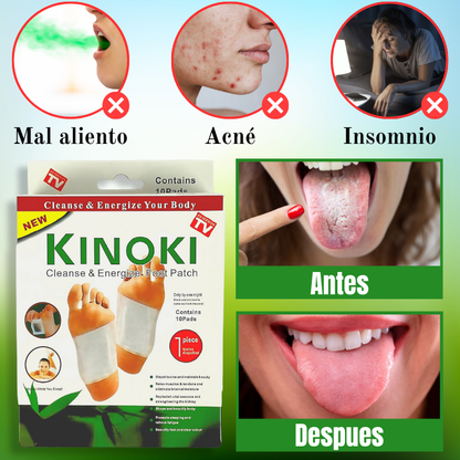 Kinoki Natural Detox™