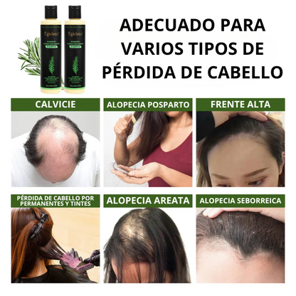 Keratina + Romero + Ortiga + Biotina - Champú Nutritivo para Crecimiento de Cabello (220 ml)
