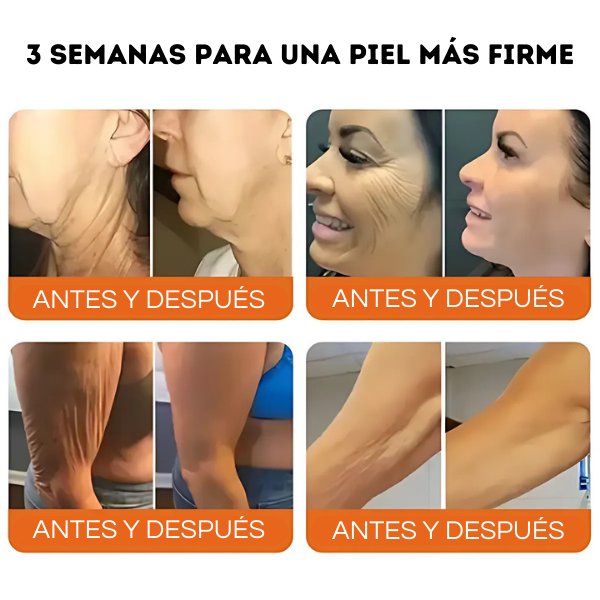 Flysmus - El Secreto para una Piel Joven y Radiante