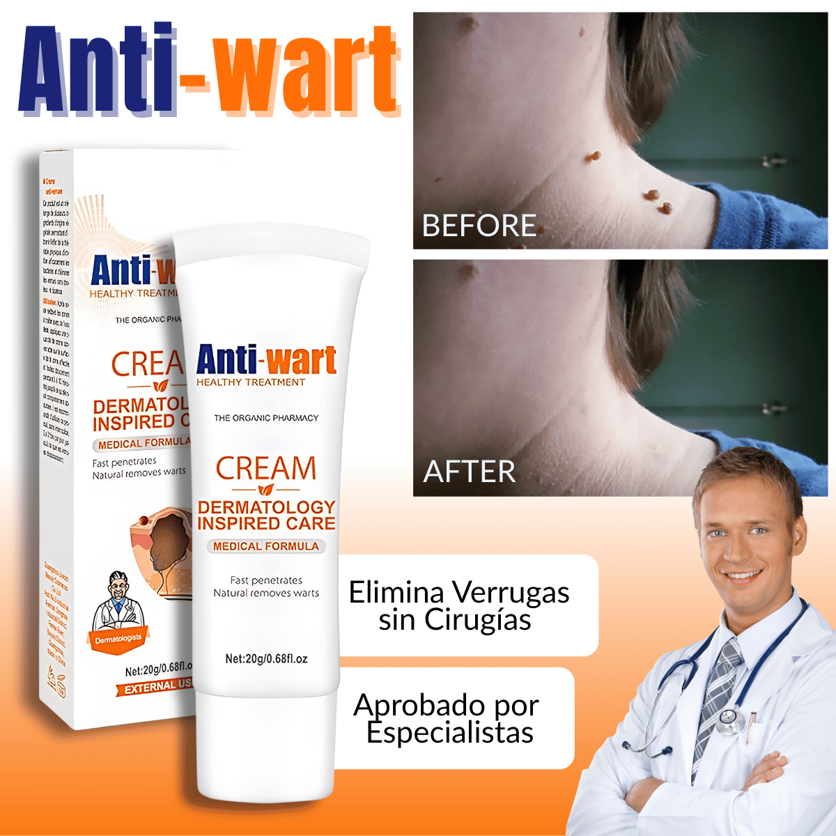AntiWart™ - Crema Anti Verrugas Aprobada Dermatológicamente